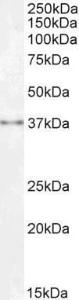 Anti-SPRY1 Antibody (A83695) (0.3µg/ml) staining of Human Kidney lysate (35µg protein in RIPA buffer). Detected by chemiluminescence.