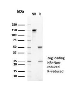 SDS-PAGE analysis of Anti-CD35 Antibody [CR1/6378] under non-reduced and reduced conditions; showing intact IgG and intact heavy and light chains, respectively. SDS-PAGE analysis confirms the integrity and purity of the antibody