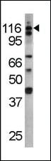 Anti-IL3R Rabbit Polyclonal Antibody