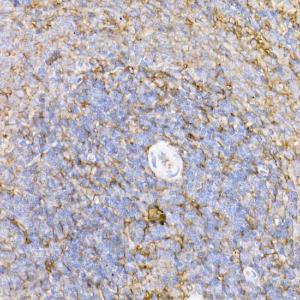 Immunohistochemistry analysis of paraffin-embedded rat spleen using Anti-ICAM1 Antibody (A9725) at a dilution of 1:100 (40x lens) Perform high pressure antigen retrieval with 10 mM citrate buffer pH 60 before commencing with IHC staining protocol