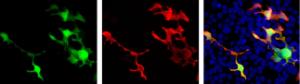 Transfected HEK293 cells which overexpress EosFP protein were stained with Anti-EosFP Antibody and viewed in a fluorescence microscope.