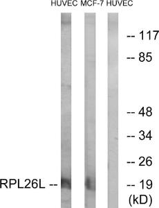 Western blot analysis of lysates from HUVEC and MCF-7 cells using Anti-RPL26L Antibody The right hand lane represents a negative control, where the antibody is blocked by the immunising peptide