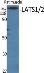 Western blot analysis of various cells using Anti-LATS1 + LATS2 Antibody