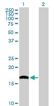 Anti-NUDT1 Rabbit Polyclonal Antibody