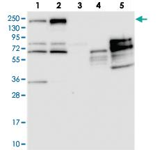 Anti-PDS5B Rabbit Polyclonal Antibody