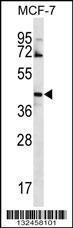 Anti-GNA14 Rabbit Polyclonal Antibody (Biotin)