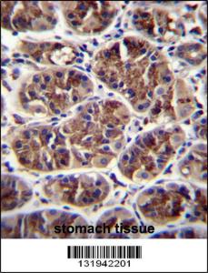 Anti-GDF5 Rabbit Polyclonal Antibody