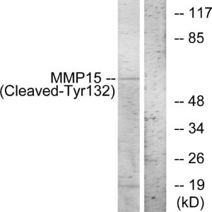 Western blot analysis of lysates from COS7 cells, treated with etoposide 25 µM 1 h using Anti-MMP15 (cleaved Tyr132) Antibody. The right hand lane represents a negative control, where the Antibody is blocked by the immunising peptide