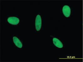 Anti-GLI3 Mouse Monoclonal Antibody [clone: 2C9]