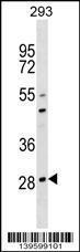 Anti-OSCAR Rabbit Polyclonal Antibody (AP (Alkaline Phosphatase))