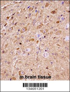 Anti-NLK Rabbit Polyclonal Antibody (APC (Allophycocyanin))