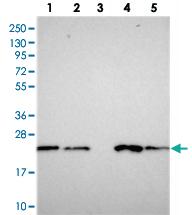 Anti-COMMD2 Rabbit Polyclonal Antibody