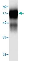 Anti-HSPD1 Mouse Monoclonal Antibody [clone: 3d566]