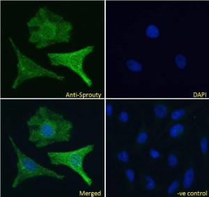 Anti-SPRY1 Antibody (A83695) Immunofluorescence analysis of paraformaldehyde fixed HeLa cells, permeabilized with 0.15% Triton