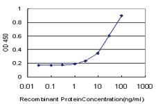 Anti-GLI3 Mouse Monoclonal Antibody [clone: 2C9]