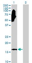 Anti-NME3 Rabbit Polyclonal Antibody