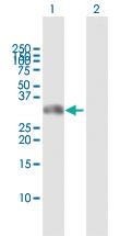 Anti-GSC Rabbit Polyclonal Antibody