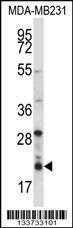 Anti-HIST1H1D Rabbit Polyclonal Antibody (AP (Alkaline Phosphatase))