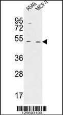 Anti-HAUS4 Rabbit Polyclonal Antibody (AP (Alkaline Phosphatase))