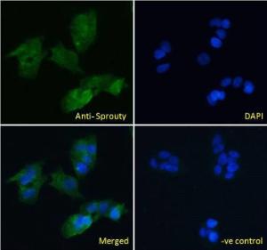 Anti-SPRY1 Antibody (A83695) Immunofluorescence analysis of paraformaldehyde fixed HepG2 cells, permeabilized with 0.15% Triton. Primary incubation 1hr (10µg/ml) followed by Alexa Fluor 488 secondary antibody (4µg/ml), showing cytoplasmic and Golgi apparatus staining.