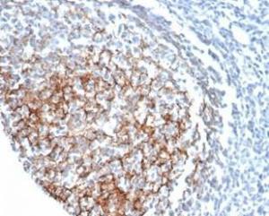 Immunohistochemical analysis of formalin-fixed, paraffin-embedded human tonsil tissue using Anti-CD35 Antibody [CR1/6378] at 2 µg/ml