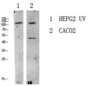 Western blot analysis of various lysate using Anti-LATS1 + LATS2 Antibody