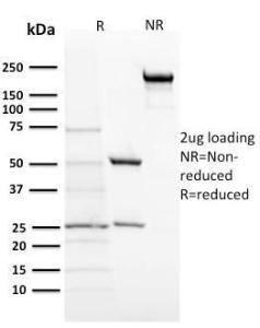 SDS-PAGE analysis of Anti-ACTH Antibody [57] under non-reduced and reduced conditions; showing intact IgG and intact heavy and light chains, respectively. SDS-PAGE analysis confirms the integrity and purity of the antibody