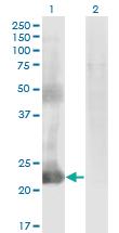 Anti-CCDC115 Mouse Monoclonal Antibody [clone: 4E9]