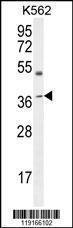 Anti-APOL6 Rabbit Polyclonal Antibody (Biotin)