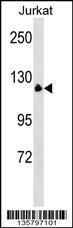 Anti-MYT1 Rabbit Polyclonal Antibody (FITC (Fluorescein Isothiocyanate))