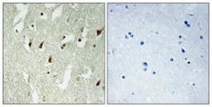 Immunohistochemical analysis of paraffin-embedded human brain using Anti-RPL26L Antibody 1:100 (4°C overnight) The right hand panel represents a negative control, where the antibody was pre-incubated with the immunising peptide