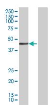 Anti-GLI4 Mouse Polyclonal Antibody