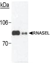 Anti-RNASEL Mouse Monoclonal Antibody [clone: 2E9]