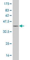 Anti-MYL6 Mouse Monoclonal Antibody [clone: 1G3]