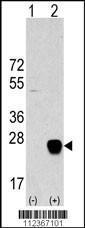 Anti-METTL7A Rabbit Polyclonal Antibody (PE (Phycoerythrin))