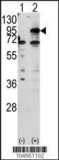 Anti-CPT1B Rabbit Polyclonal Antibody (FITC (Fluorescein))