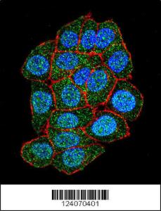 Anti-ASXL1 Rabbit Polyclonal Antibody