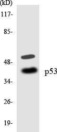 Western blot analysis of the lysates from K562 cells using Anti-p53 Antibody