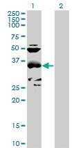 Anti-CCBL1 Mouse Polyclonal Antibody