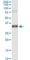 Anti-GSC Rabbit Polyclonal Antibody