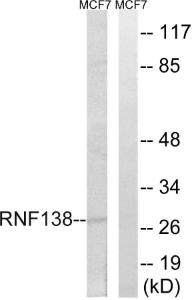 Antibody anti-RNF138 100 µg