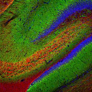 Immunofluorescent analysis of rat hippocampus section stained with Anti-MAP2 Antibody (1:5,000 / green) and Anti-a-Internexin Antibody (A85441 / 1:2,000 / red)