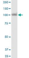 Anti-MTHFD1 Mouse Polyclonal Antibody