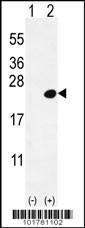 Anti-DOK5 Rabbit Polyclonal Antibody (AP (Alkaline Phosphatase))