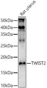 Western blot analysis of extracts of Rat uterus, using Anti-Twist2 Antibody (A9726) at 1:1,000 dilution The secondary antibody was Goat Anti-Rabbit IgG H&L Antibody (HRP) at 1:10,000 dilution Lysates/proteins were present at 25 µg per lane