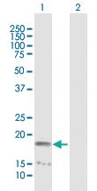 Anti-NME4 Mouse Polyclonal Antibody