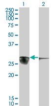 Anti-CACYBP Mouse Monoclonal Antibody [clone: 2E3]