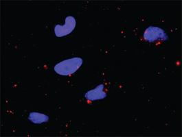 Anti-BIRC2 + CASP9 Antibody Pair