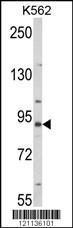 Anti-MFN2 Rabbit Polyclonal Antibody (Biotin)