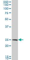 Anti-NQO2 Mouse Polyclonal Antibody